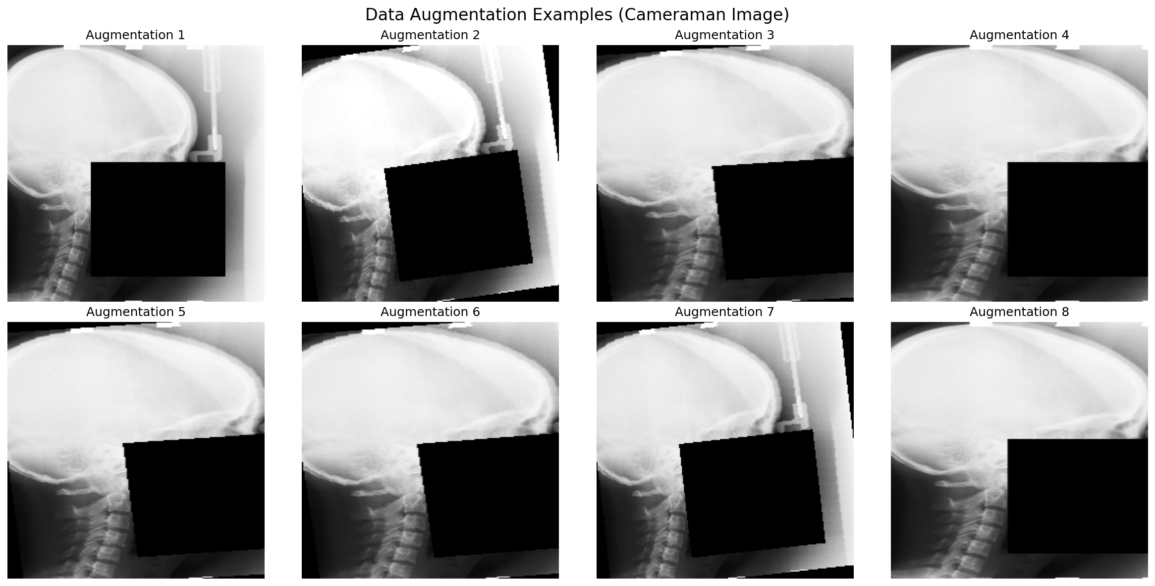 augmentation_examples