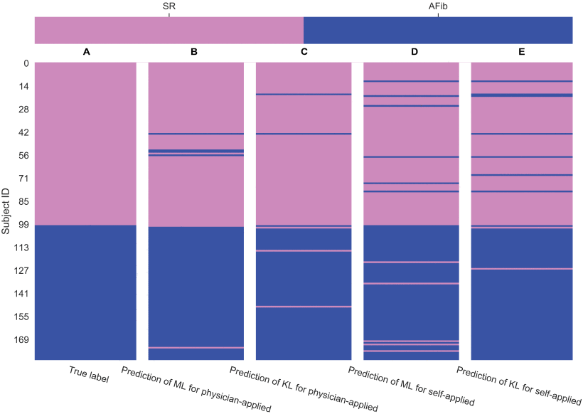 Reliability of atrial fibrillation detection